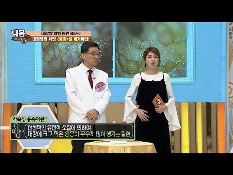 대장암의 씨앗 ‘용종’ 내 몸 속에 수천 개가 있다?! [내 몸 사용설명서] 138회...