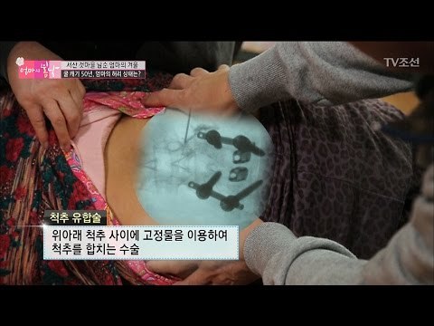 굴 캐기 50년, 엄마의 허리 상태는? [엄마의 봄날] 72회 20170115