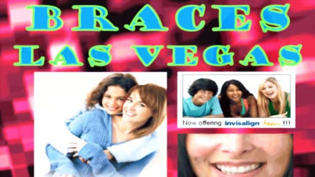 Invisalign Las Vegas