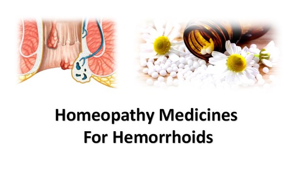Homeopathic Treatment For Hemorrhoids : 10+ Best Homeopathic Medicines For Piles