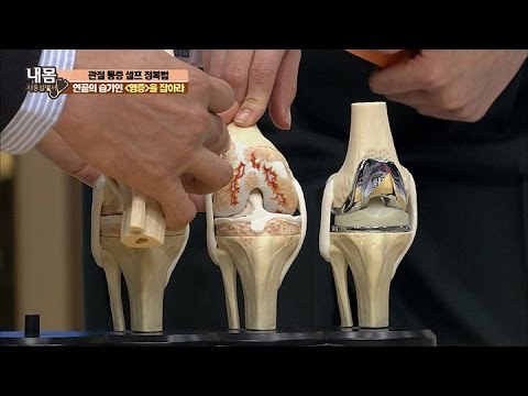 연골의 염증을 잡아라! 관절 건강법! [내 몸 사용설명서] 134회 20161223