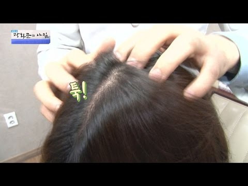 대머리 되기 전에 두피를 지켜라! 두피 지압법! [광화문의 아침] 383회 20161220