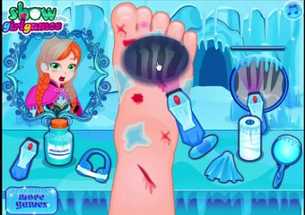 Disney Frozen Game Frozen Anna Foot Doctor Baby Videos Games For Kids