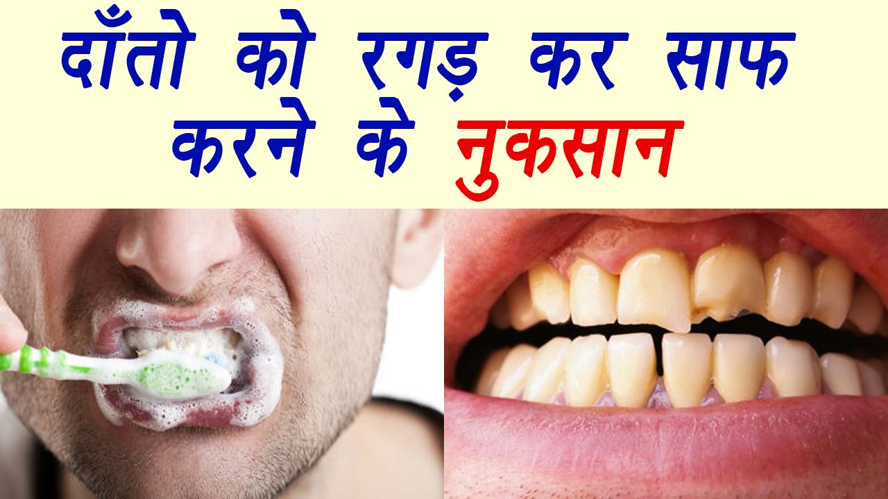 Brushing FAST harmful for teeth; Here's why | दांतों पर तेज़ ब्रश रगड़ने के नुकसान | Boldsky