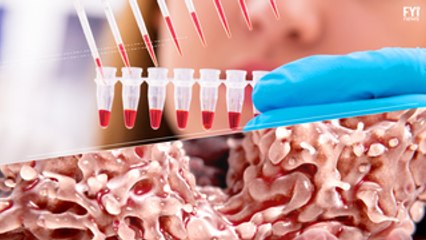 A Terapia Celular é a nova solução terapêutica