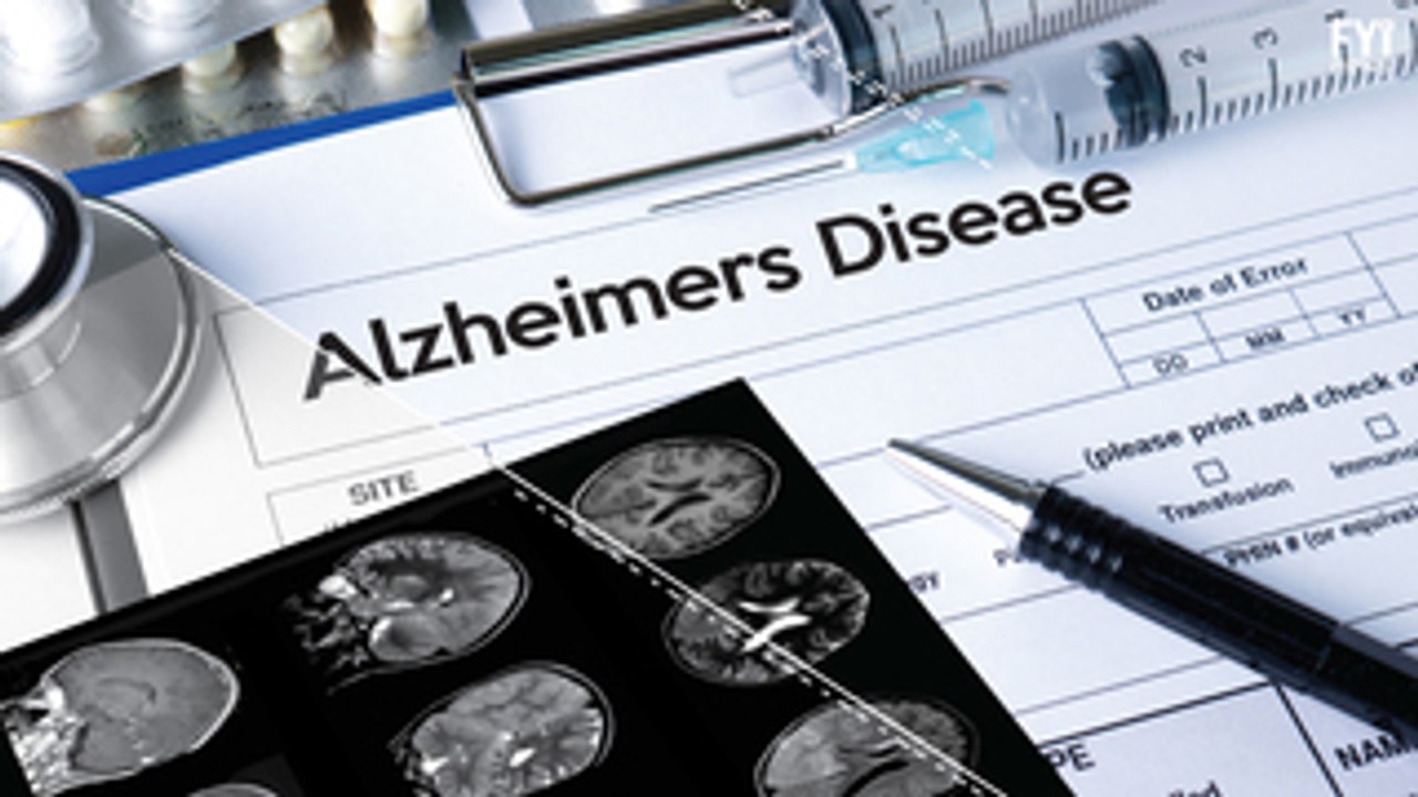 Novo teste detecta Mal de Alzheimer