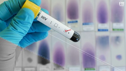 Novo tratamento para HIV é promissor