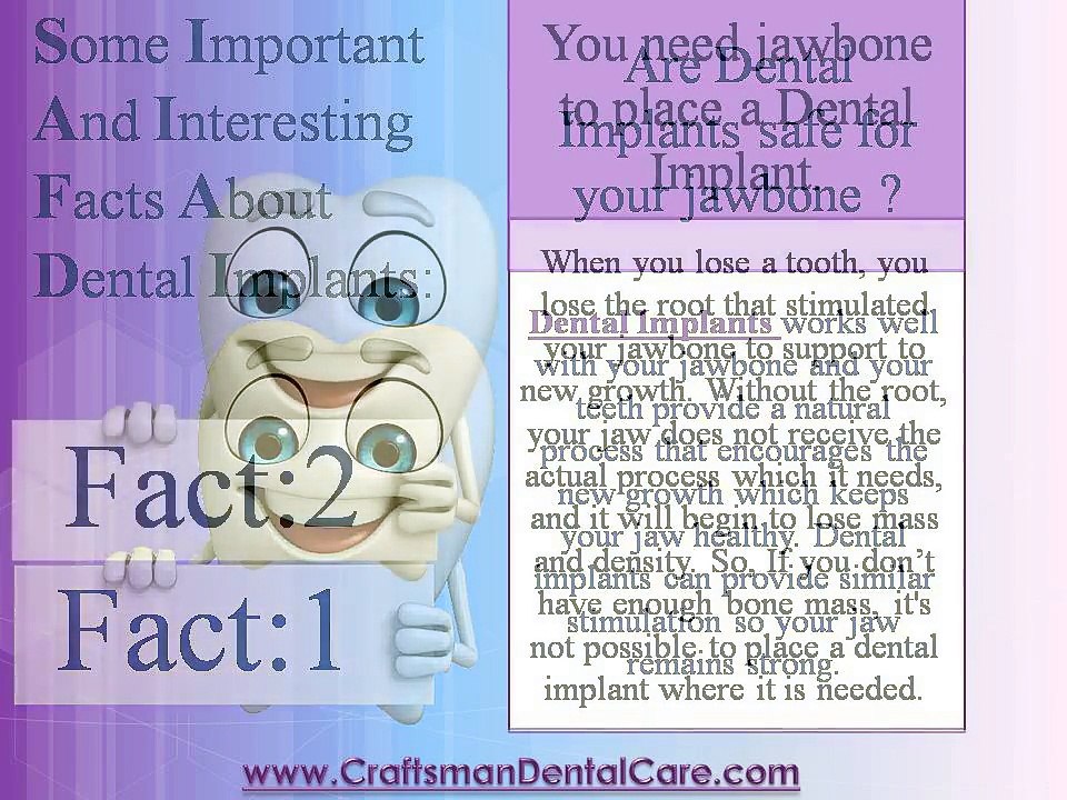 Interesting Facts about Dental Implants - Sacramento