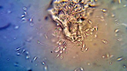 5-dieu-ban-co-the-chua-biet-ve-tinh-trung-1493887012