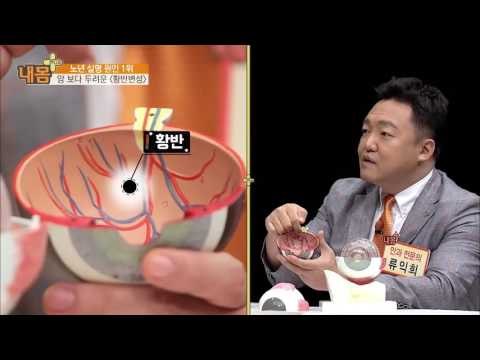노년 실명 원인 1위 ‘황반변성’ [내 몸 플러스] 30회 20161030