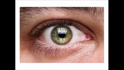 What is Glaucoma Really