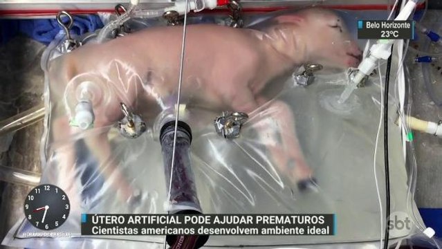 Cientistas desenvolvem útero artificial que pode ajudar bebês prematuros