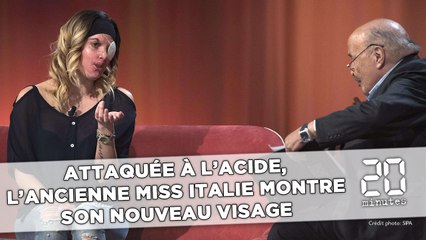Attaquée à l'acide, l'ancienne Miss Italie 2007 montre son nouveau visage