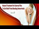 Natural Treatment For External Piles To Get Relief From Bleeding Hemorrhoids