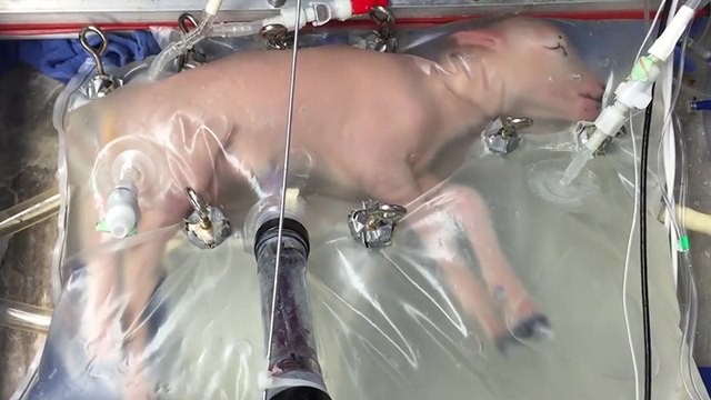 Des agneaux se développent dans un utérus artificiel