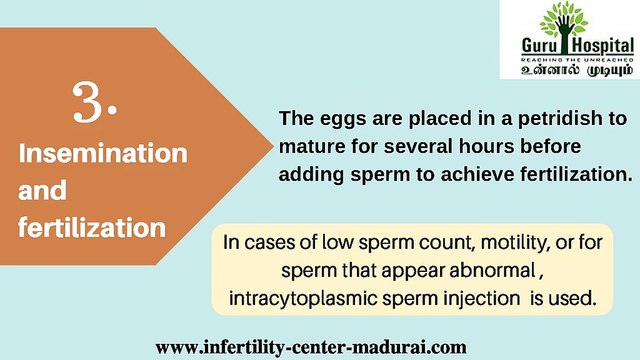 IVF Treatment In Madurai | Best Infertility Centre In Tamil Nadu