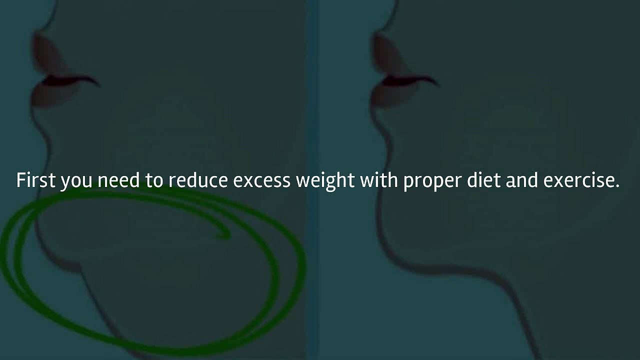 how to get rid of double chin, face fat, chubby cheeks, weight loss,