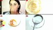 How to Remove BLACK SPOTS , DARK SPOTS & ACNE SCARS on face _ONLY in 5 days