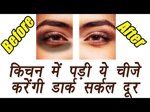 Dark circle home remedis, आंखों के काले घेरे दूर करेंगी किचन में पड़ी ये चीजें | BoldSky