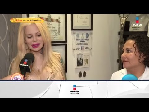 A pesar de todo, Sabrina se volvió a operar | Sale el Sol | Imagen Entretenimiento