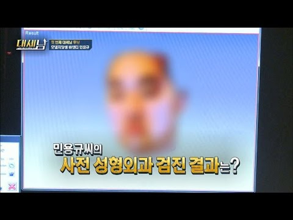 주걱턱이 심각한 그의 현재 상태! [대세남] 7회 20161001