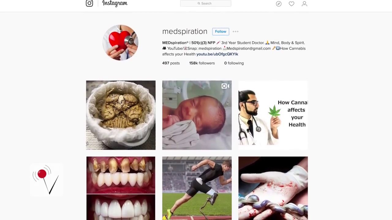 This Is What Your Lungs Look Like After Smoking Just 20 Cigarettes