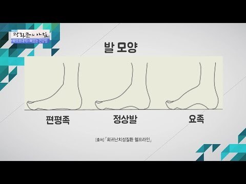 신발만 잘못 신어도 발생하는 족저근막염 [광화문의 아침] 324회 20160927