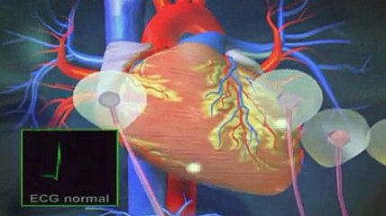 Système de conduction