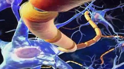 La sclérose latérale amyotrophique (SLA) expliquée en vidéo