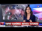 Tıpta devrim yaratacak deney Yapay rahimle hayata tutundu