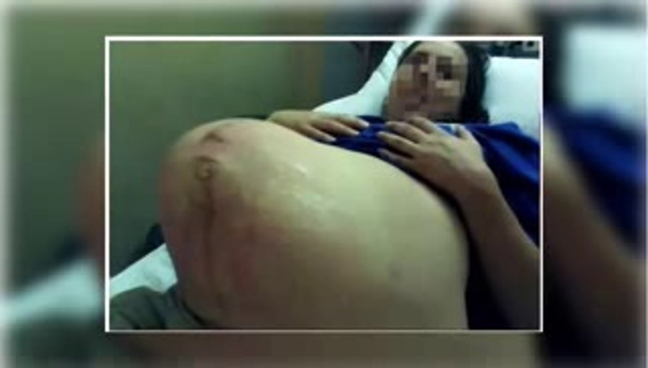 Llevaba 3 años embarazada y no quería ir al doctor. Algo extraño crecía en ella