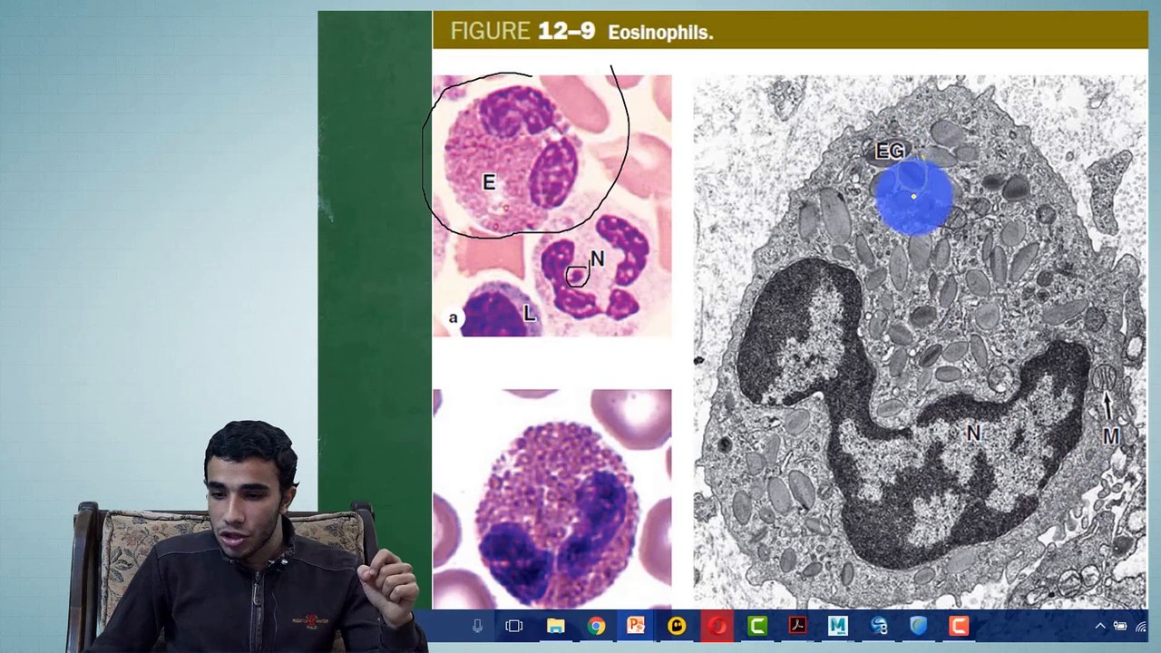 2 Leucocytes1 Granulocytes (Neutrophils  Eosinophils  Basophils)  Jaundice  Sickle Anemia (Part 2)