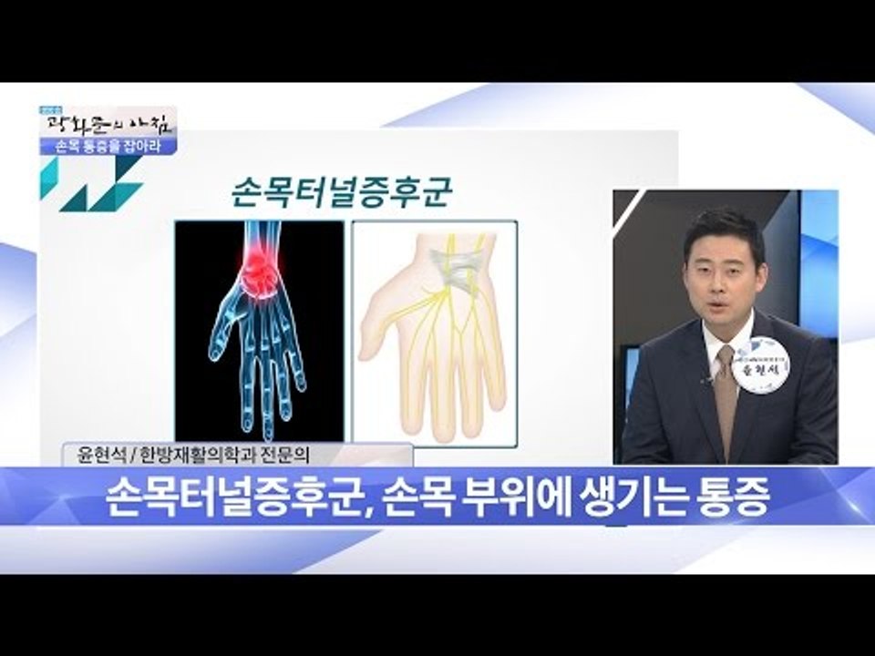 손목터널증후군이란? [광화문의 아침] 306회 20160830