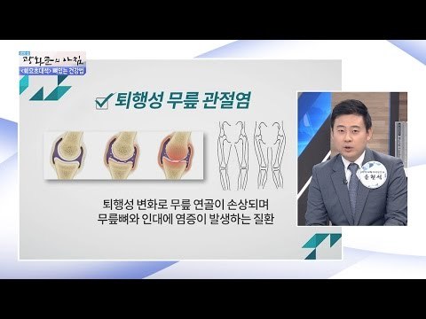 무릎 관절염 발생의 원인은? [광화문의 아침] 292회 20160809