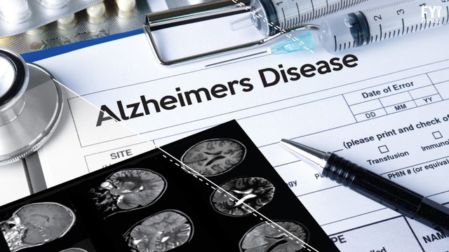 A Closer Step to Curing Alzheimer's