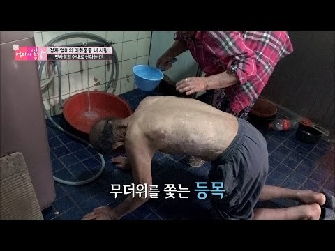 고집쟁이 남편의 몸에 남은 화상자국... [엄마의 봄날] 53회 20160807