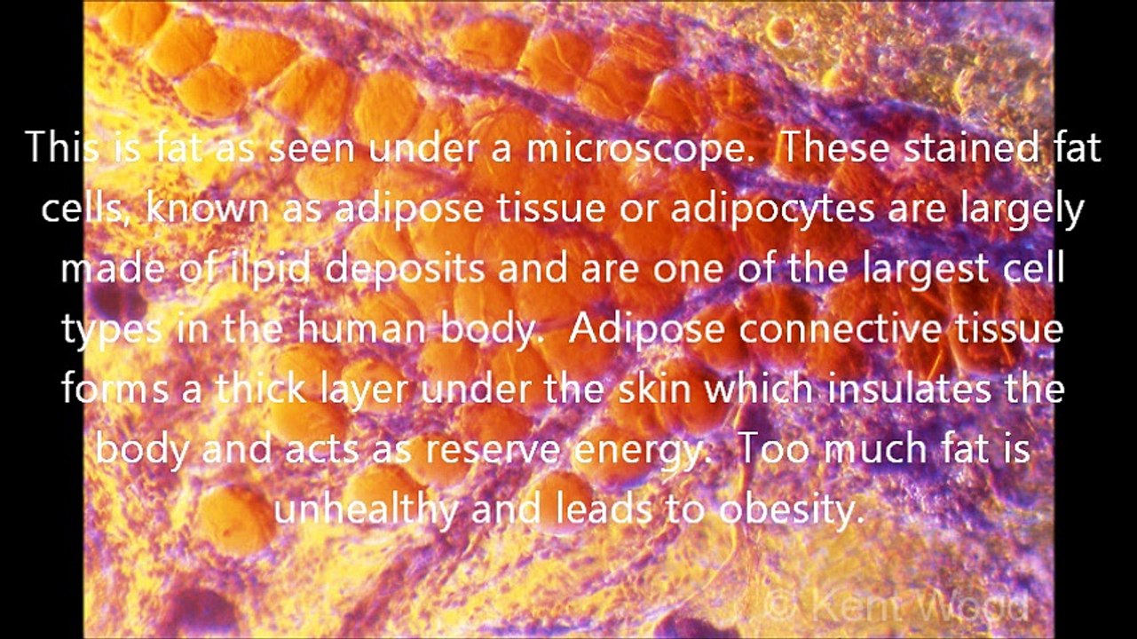 Fat Bad or Bad fat by Dr. David Evdokimow in New Jersey