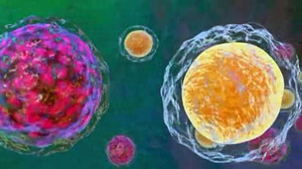 Lymphome non Hodgkinien