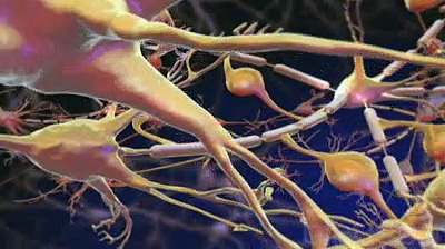 Neuropathie diabétique