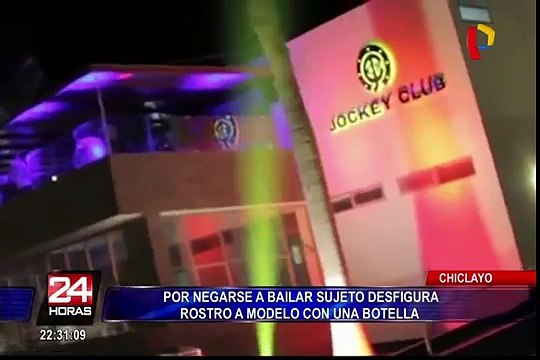 Chiclayo: modelo desfigurada presentó denuncia contra su agresor