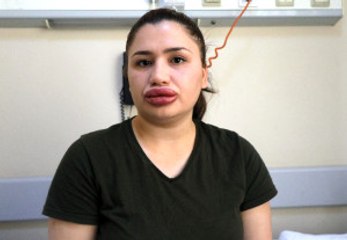 'Doktor' Sandığı Kuaföre Dolgu Yaptıran Fatma Hemşire: Çok Pişmanım