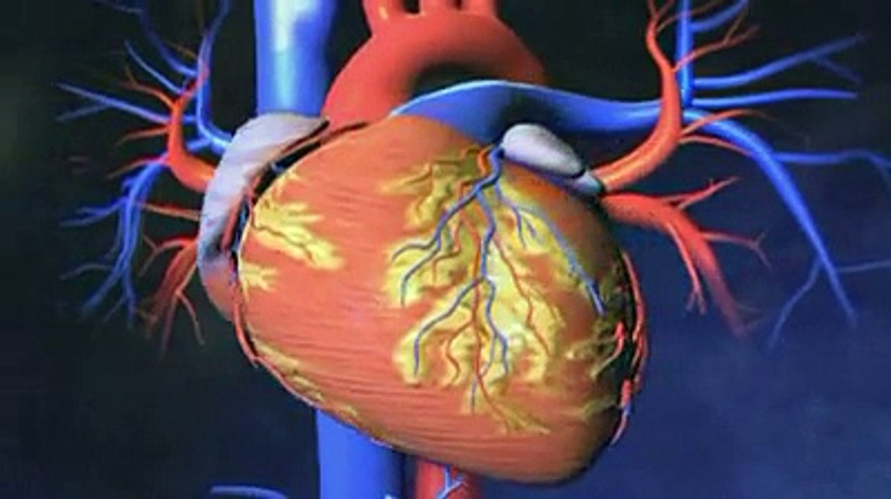 Ablation par radiofréquence