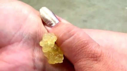 Woman Has Huge Cyst On Her Wrist Drained - Eww Video _ eBaum's World