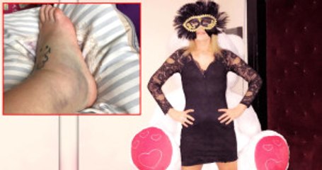 Seda Akgül, Ayağının Şiş Halini Paylaştı: Bahislere Açığım