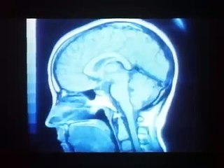 Brain Dead OFFICIAL Trailer