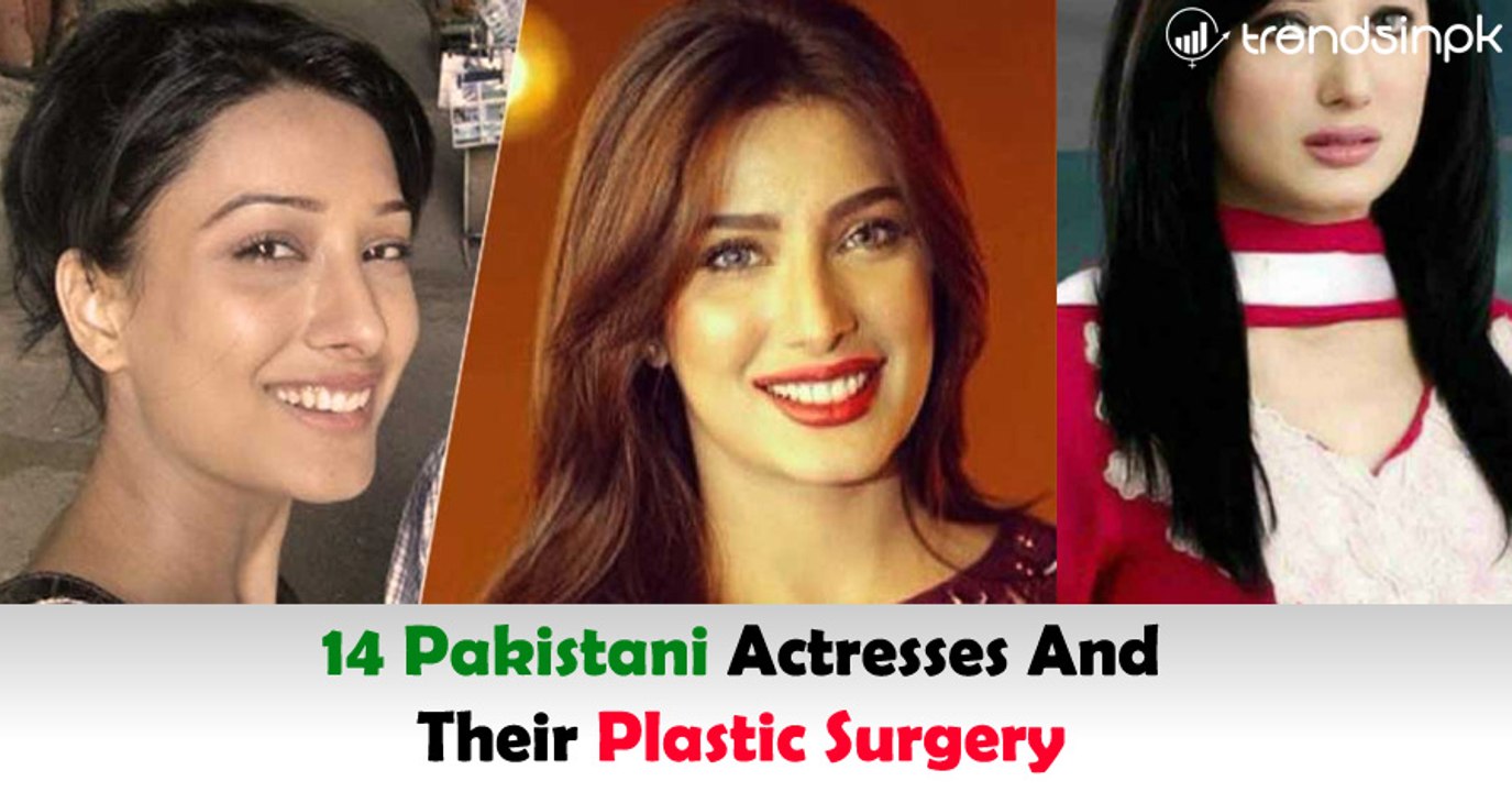 14 Pakistani Actresses And Their Plastic Surgery