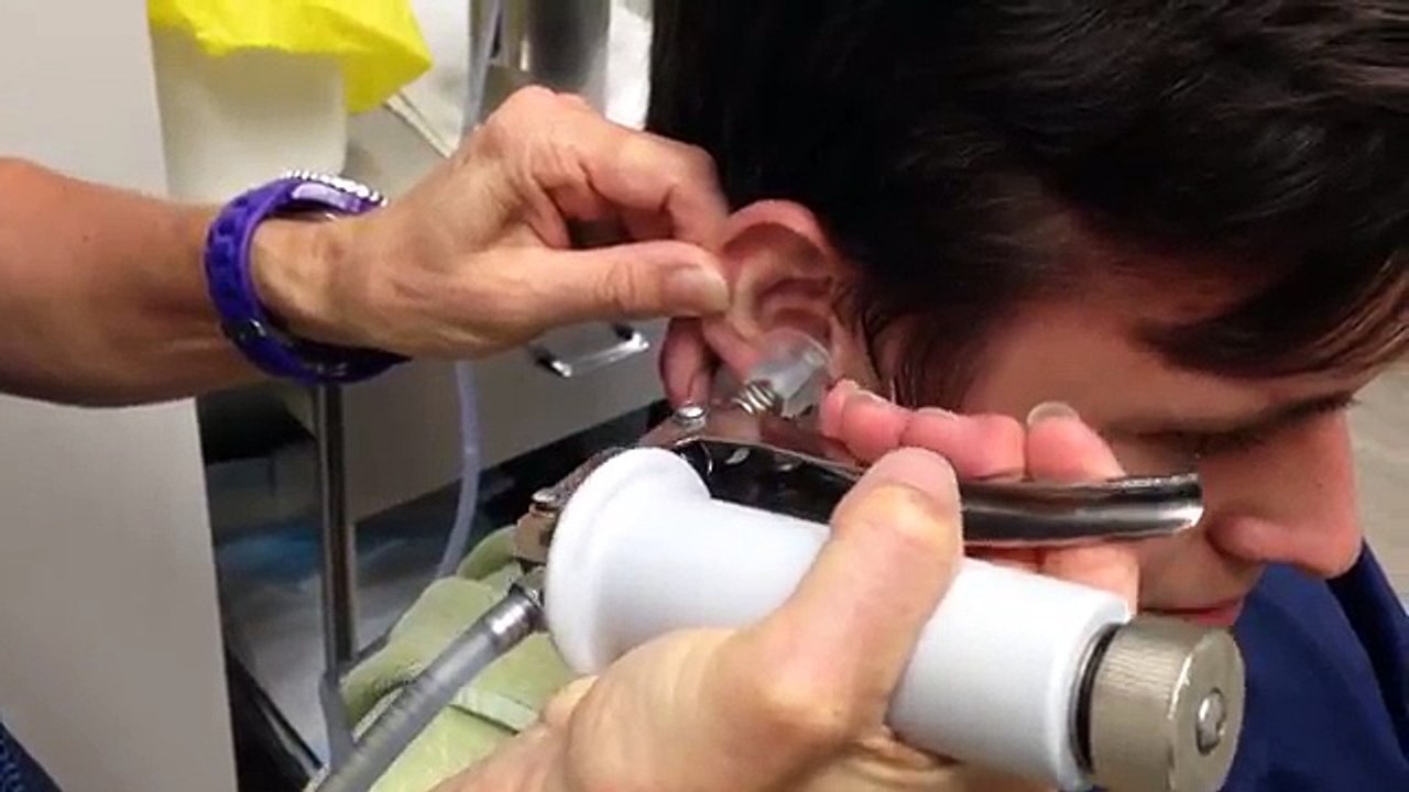 Ce spécialiste injecte de l'eau dans l'oreille de son patient. Ce qu'il va en ressortir est inimaginable !