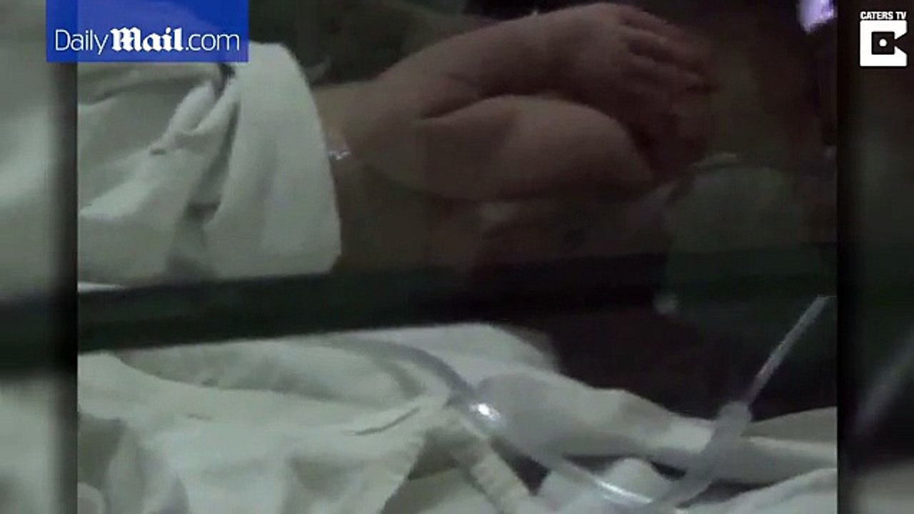 Indian baby is born with an additional HEAD attached to its stomach