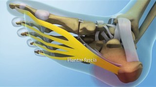 How to Tell the Difference: Plantar Fasciitis vs. Achilles Tendinitis