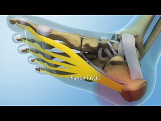 How to Tell the Difference: Plantar Fasciitis vs. Achilles Tendinitis